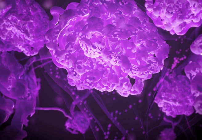 Prediction of disease progression  Prediction of disease progression