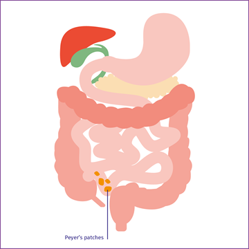 Illustration showing the location of Peyer's patches in the distal ileum
